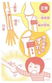 �q59�r�I���� �u�I�֐߂̒E�P�v�͌��