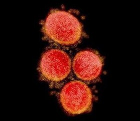 �Y�Y�s�c���R���i���� 7�����I�A9���Ɉψ���ɏo��