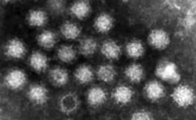 ����̈��H�X��80�l�H���Ł@�q�Ə]�ƈ�����m���E�C���X���o