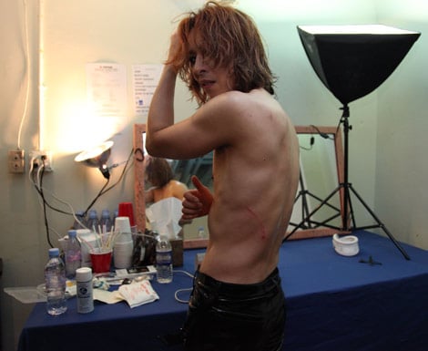 X JAPAN14年ぶりツアー中のYOSHIKIが甲状腺機能亢進症を公表　
