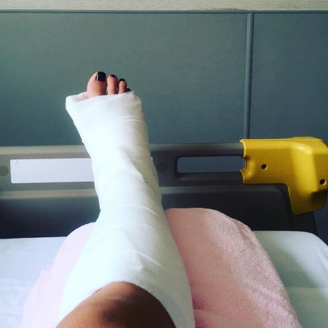 画像 写真 道端アンジェリカ 右足首脱臼 骨折3ヶ所で全治2ヶ月の重傷 2枚目 Oricon News