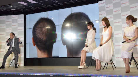 画像 写真 東国原英夫 薄毛進行止まる 比較写真に疑惑も 加工した感じが 2枚目 Oricon News
