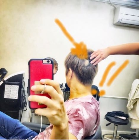 Gackt 円形脱毛症の写真を公開 どんな嫌なことも必ず笑い話になる Oricon News