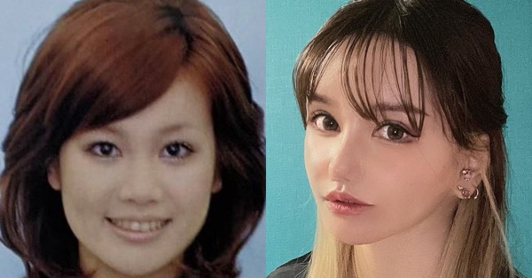 整形美女 友達だけ連絡先を聞かれる屈辱も 顔に3000万かけた女性があえて整形を強みにする覚悟 Oricon News
