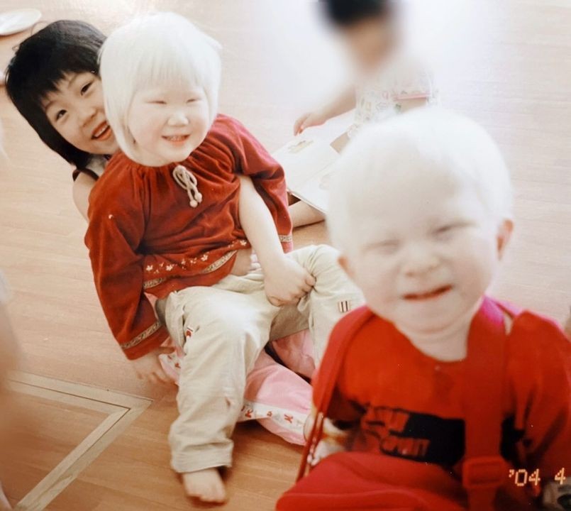 画像・写真 | アルビノ女性とバチ指を持つ美容師が発信で得たハンデと