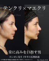 ���������搶 