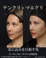 ���������搶 