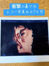 �}�}�Ռ��A�G�R�[�Łg�@�ł��h��I�����x�r�[���Y�܂ꂽ��c����7�����̎p�Ɂu�����!������������v�u�}�}��������v 