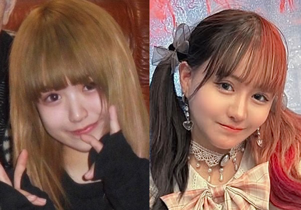 整形アイドル”プロデューサー、自身の整形に2500万円以上をかけて