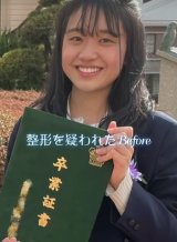 �w���R���v�������@����_�@�ƂȂ�A�h�O���̍C�����h ��w�󌱂Ɏ��s���������C���t���G���T�[�����̓w�͂Ƃ�? 