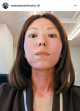 40�΁E��ΐ�āA�g�^���ԂȊ�h�̂����҂�V���b�g�u��u�ł�܂����v�u�V�~�V���ЂƂ��Ȃ��̑A�܂����v 