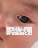 �y�K�^�̏؁@���܂���̃A�U�z���B�i�摜�񋟁�nonmamagram_27�j 