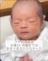 �y�K�^�̏؁@���܂���̃A�U�z���B�i�摜�񋟁�nonmamagram_27�j 