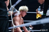 【RIZIN】鈴木千裕、驚異の稲妻リカバリー!朝倉未来との激闘から8日、傷とともにメンタルも復活 