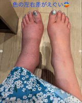 �g�̂̔Y�݂𖾂����������Ďq (�ʐ^�̓C���X�^�O����@shoko55mmts ���) 