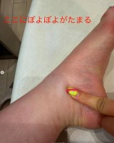 �g�̂̔Y�݂𖾂����������Ďq (�ʐ^�̓C���X�^�O����@shoko55mmts ���) 
