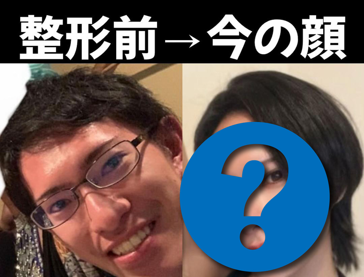 整形に700万円かけた男性美容外科医のリアルな体験談に1000万回再生