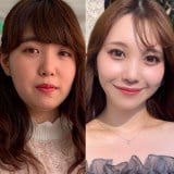 ���ʑO�ƌ��ʌ�̃r�t�H�[�A�t�^�[(@nepi_first���) 