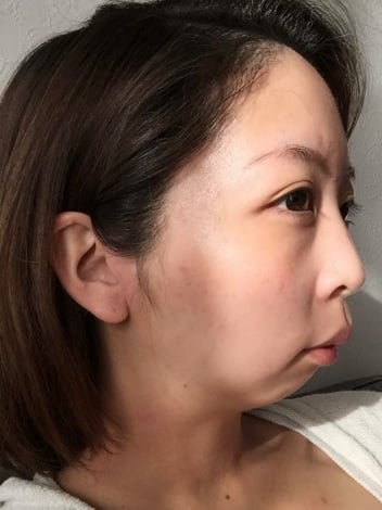 �C�����O�̃e�B�i����i��tina.beauty107���j 