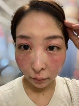 �@���`�����s���A�@���Ȃ����Ă��܂��A��ɂ��X�g���X�����@���]���o�Ă��܂����e�B�i����i��tina.beauty107���j 