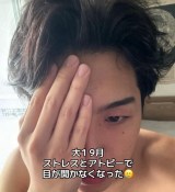 �X�g���X�ƃA�g�s�[�Ŗڂ��J���Ȃ��Ȃ����Ƃ�����w1�N����9��(@kumabe_takatomo���) 