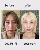 ���̒��̘V�����񂾎����Ɂu���������Ȃ閈���ł����v50�㏗���̌��ӁA���e��È�؂Ȃ��Ŏ�Ԃ���1�N���̋O�� 