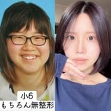 ��6�̂Ƃ��ƁA���݂̃q�g�~����̃r�t�H�[�A�t�^�[(@user7813605115012���) 