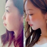 �e�B�i����̉���r�t�H�[�A�t�^�[(@tina.beauty107���) 