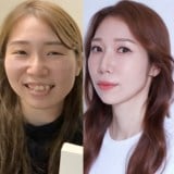 ���`�O�Ɛ��`���anzoochan����̃r�t�H�[�A�t�^�[(@anhangban92���) 