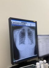 �L���S���̃����g�Q���ʐ^(����X(@CocoroToyoshima)���) 